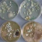 Bioaerosole - Mikrobielle Luftverunreinigungen